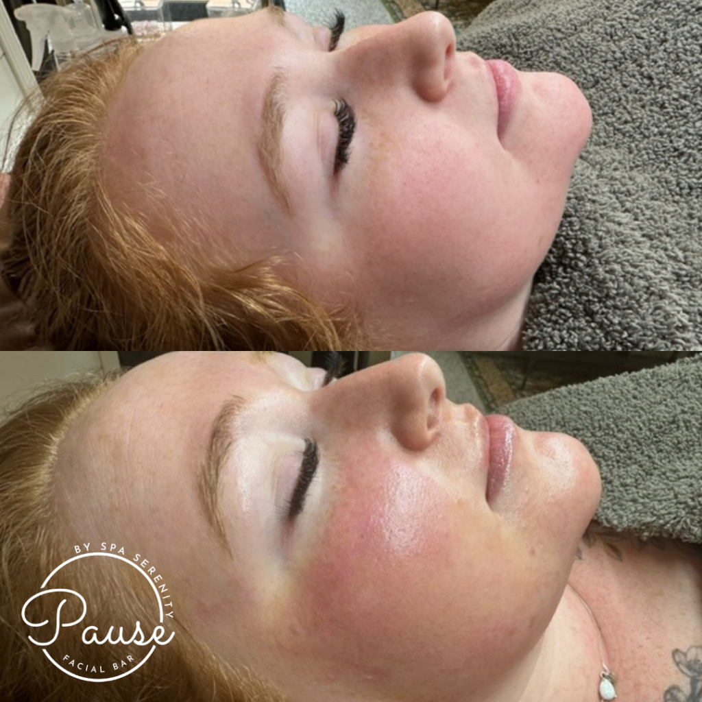 Your Skin Has Been Working All Winter Your Skin Has Been Working All Winter